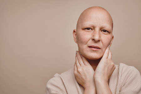Minimal head and shoulders portrait of bald woman looking at camera while posing against beige background in studio, alopecia and cancer awareness, copy spaceの写真素材