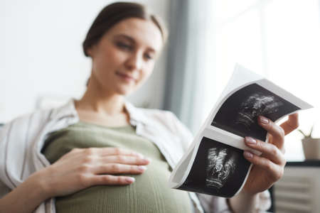 Pregnant woman holding x-ray image of her baby during her rest on the sofa at homeの写真素材