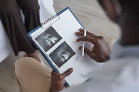 Close-up of African doctor holding clipboard and examining ultrasound image with patient visiting him at hospitalの写真素材