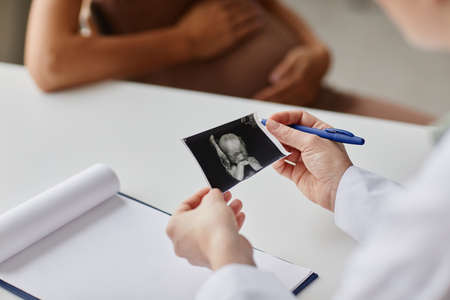 Close-up of doctor examining the embryo ultrasound image sitting at the table and talking to pregnant woman during her visitの写真素材