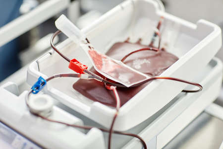 Close up of filled blood bags in tray at blood donation center, copy spaceの写真素材