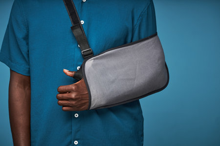 Close up of unrecognizable black man wearing arm sling against vibrant blue background, copy spaceの写真素材