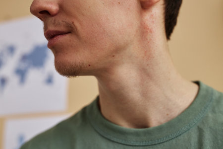 Side view closeup of young man with skin rash or psoriasis spots on neck, copy spaceの写真素材