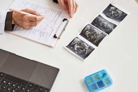 Top down close up view of unrecognizable obstetricians hand filling in medical card and baby ultrasound scan on table in maternity hospitalの写真素材
