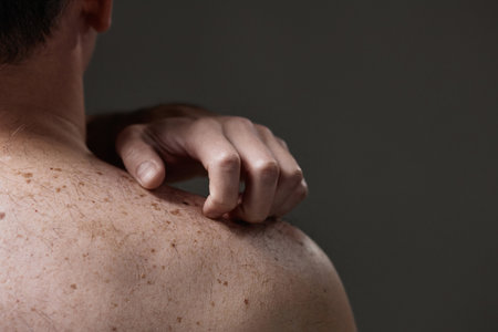 Middle aged Caucasian man scratching shoulder showing skin with visible moles and freckles highlighting dermatological concernの写真素材