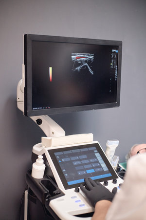 Vertical shot of Caucasian young adult woman operating vascular ultrasound machine in medical...