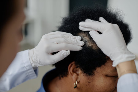 Middle aged Black woman sitting while healthcare professional wearing gloves examining scalp for dermatological condition during medical consultation in clinical settingの写真素材