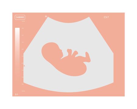 Ultrasound icon. Maternity icon. Ultrasound of baby in mothers womb. Fetus in womb. Medical...