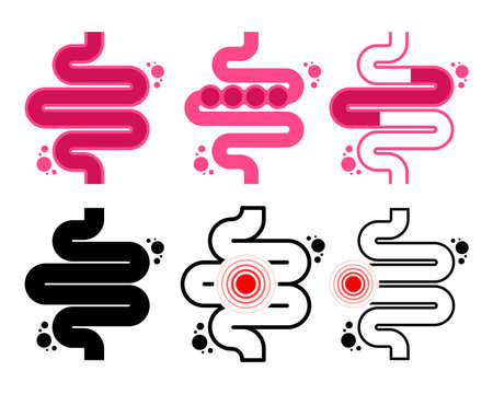 Colitis. Stomach. Gut constipation, Abdominal and bloating vector. Gastroenterology for medical. Health care concept. Vector illustration.のイラスト素材
