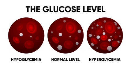Glucose in the blood vessel. Normal levels, hyperglycemia, hypoglycemia. Normal, high and low blood sugar. Blood diagram. Vector illustration.のイラスト素材