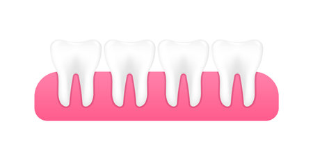 Dental model of teeth in the gum. Concept of dental examination of teeth. Dental health and hygiene. Realistic tooth model. Vector Illustration.のイラスト素材