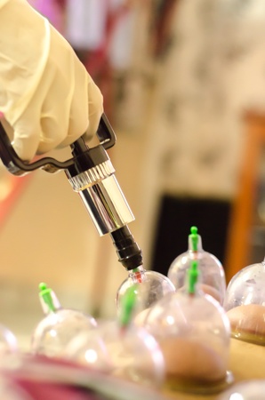 Hand of Cupping