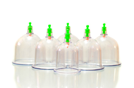 Cupping or Bekam Hijamah is traditional treatment