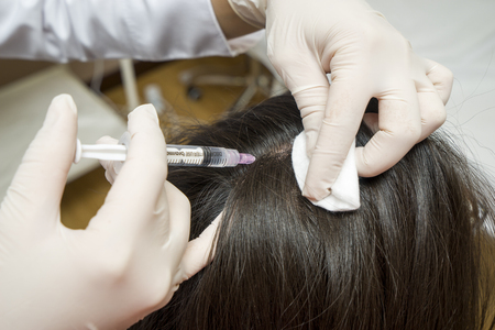 Procedure of mesotherapy. The doctor cosmetologist makes the procedure of mesotherapy in womans head. Strengthen hairの写真素材