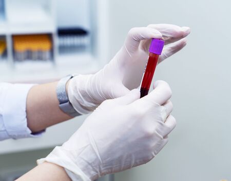 A female doctor in white rubber gloves holds a test tube with a blood sample in the laboratory