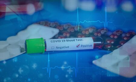Corona virus Covid-19 novel corona virus conceptの写真素材