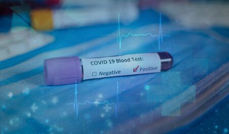 Corona virus Covid-19 novel corona virus conceptの写真素材