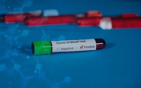 Corona virus Covid-19 novel corona virus concept