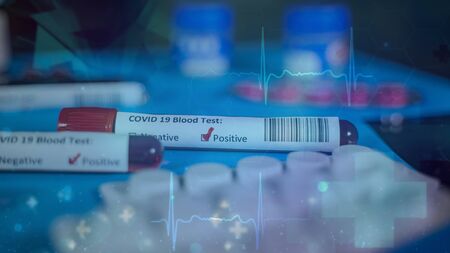 Corona virus Covid-19 novel corona virus conceptの写真素材