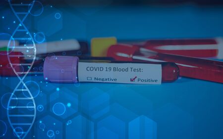 Corona virus Covid-19 novel corona virus conceptの写真素材