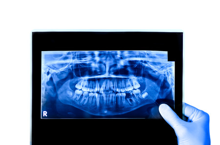 Dentist holding  viewing full mouth X-ray of a patient isolated in white backgroundの写真素材