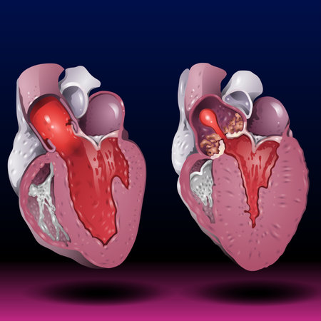 Human heart anatomy. Vector illustration of human heart anatomy isolated on dark backgroundの写真素材