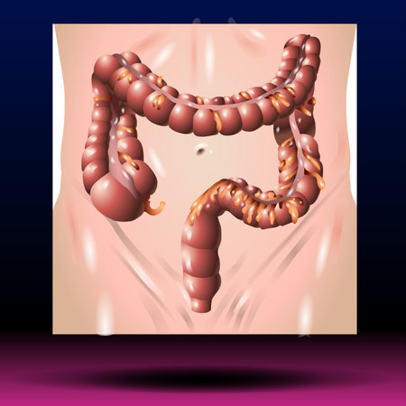 Human digestive system. Inflammation of the stomach. Vector illustrationの写真素材