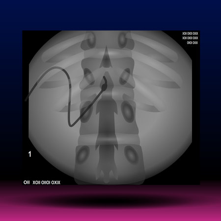 X-Ray image of human spine. Vector illustration, EPS 10の写真素材