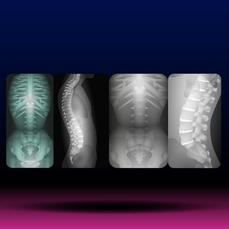X-Ray image of human spine. Vector illustration on dark background.の写真素材