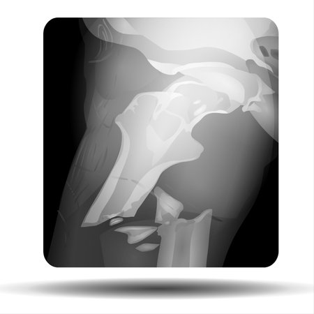 X-ray of human knee. Vector illustration. Eps 10.の写真素材