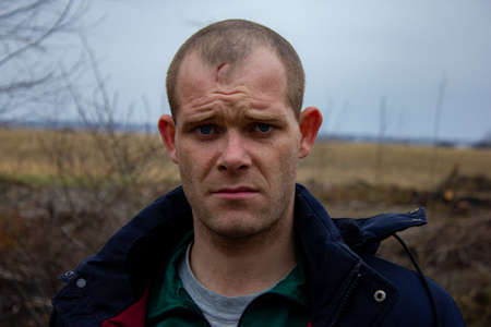 Motyzhyn, Kyiv region, Ukraine - April 2022: War Russia Ukraine. Volunteer Andrei Verbitsky, captured by Russian soldiers. He was shot and survived.のeditorial素材