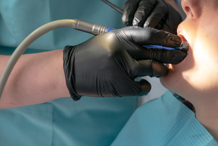 Female orthodontist dentist heal teeth with a stomatology instrumentの写真素材