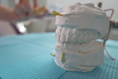 Orthodontic model - artificial jaws closeup with orthodontic cabinet on a backgroundの写真素材