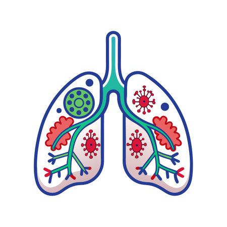 Lung Pneumonia Caused by Bacteriaのイラスト素材