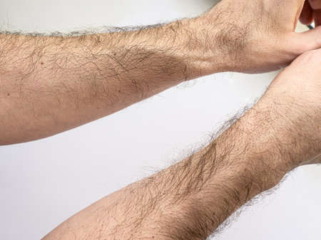 long dark hair on male hands - a symptom of increased testosterone in menの写真素材