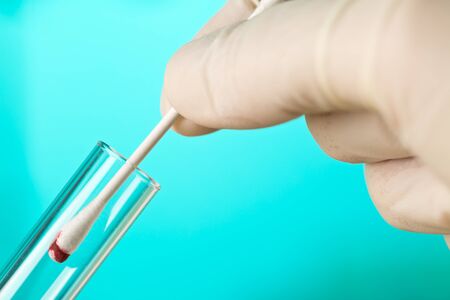 Crime scene investigation CSI forensic collecting blood sample evidence on buccal swab into test...