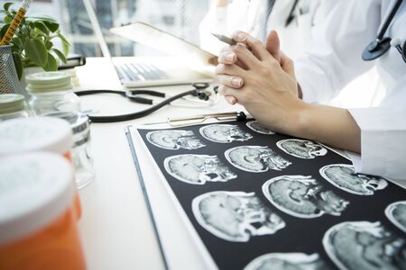 The doctor thinks while looking at the X-ray picture.の写真素材