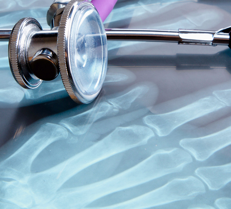 A medical stethoscope on an x-ray picture, closeup