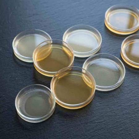 Petri dishes with bacterial colonies on a black background. Microbiology.