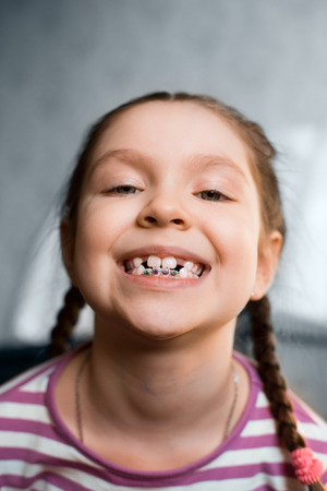 Close up portrait of Smiling girl showing dental braces.の写真素材