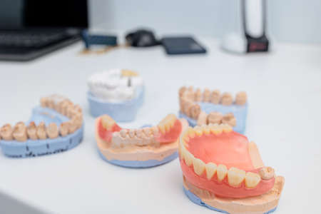 Dentures on a white background. Close-up of dentures. Full removable plastic denture of the jaws....