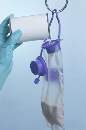 Nurse adds can of enteral feeding nutritional supplement to enteral feeding bag.の写真素材