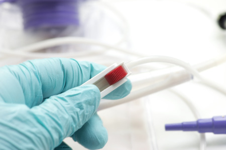 Close-up of nurse adjusting flow regulator on enteral feeding bag.の写真素材