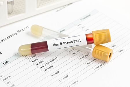 Hepatits test blood analysis collection tube with blood collection supplies.  Serial number is...