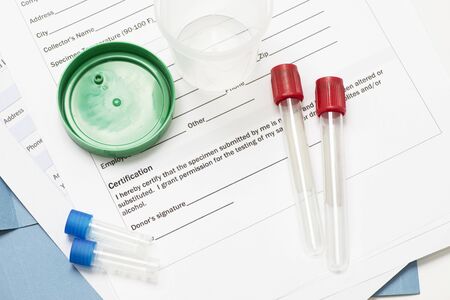 Drug screen document certification with urine, blood and sample containers and tubes.の写真素材