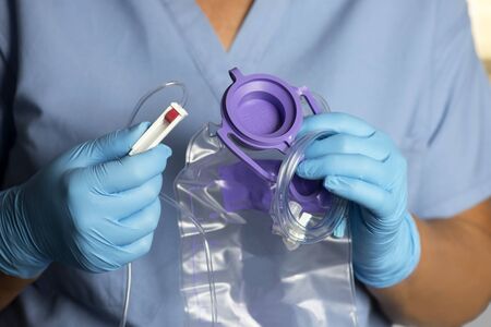Nurse holds enteral feeding bag and tubing prior to administration.
