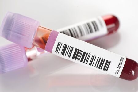 Blood test tubes with lavender or purple tops. Used for blood tests such as Complete blood cell counts, hbA1c,  and anemia.の写真素材