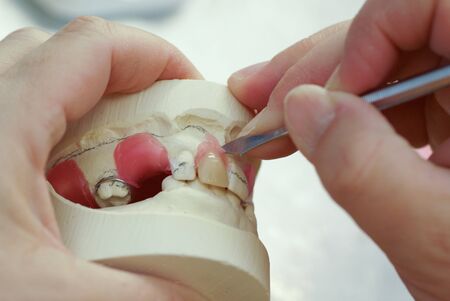 Dental technician making new dentures with plaster model