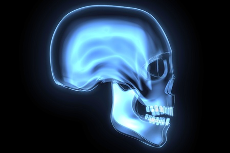skull x-rayの写真素材