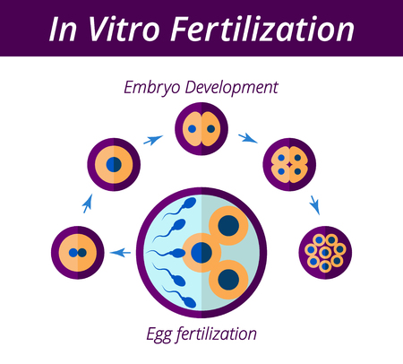 Scheme of artificial insemination. In vitro fertilization chart. Cell division stages. Flat style EPS 10 vector illustration. Isolated on white background.のイラスト素材